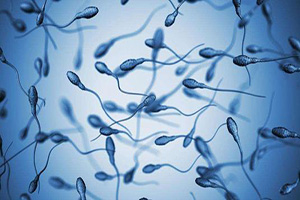 精子过多也会导致不育？为什么？